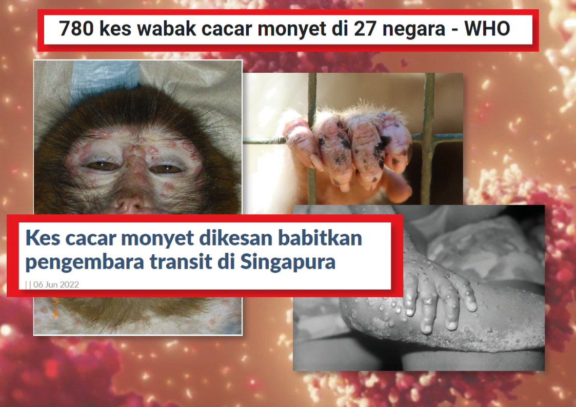 fakta-monkeypox-cacar-monyet